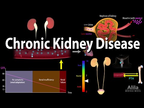 chronic kidney disease animation