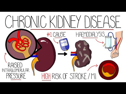 understanding chronic kidney disease ckd
