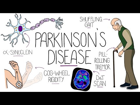 understanding parkinsons disease including direct and indirect pathways
