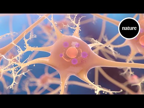 understanding parkinsons disease